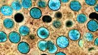 microscopy image monkeypox